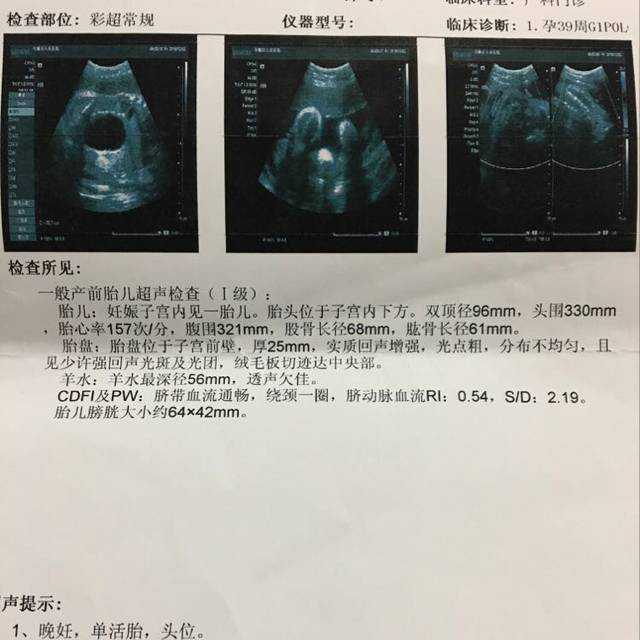 北京代孕费用详细表-北京的代孕价格