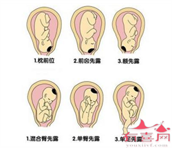 北京高龄供卵代怀，北京助孕妈妈付款流程