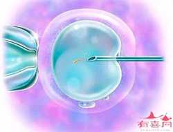 北京供卵试管包生男孩机构，北京私立医院助孕